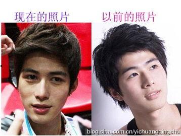 娱乐圈吃瓜爆料男星整容,男星整容风波,真相背后竟是这样... 第2张 娱乐圈吃瓜爆料男星整容,男星整容风波,真相背后竟是这样... 第2张